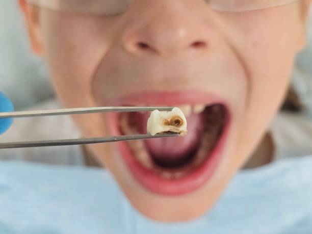Best Holiday Emergency Dentist in Bear Creek Ranch, TX