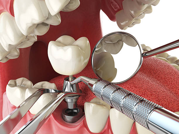 Best Emergency Cosmetic Dentistry in Bear Creek Ranch, TX